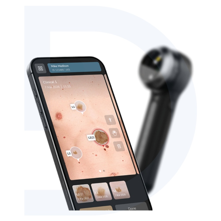 DermatoscoopDL5Plus_02.jpg